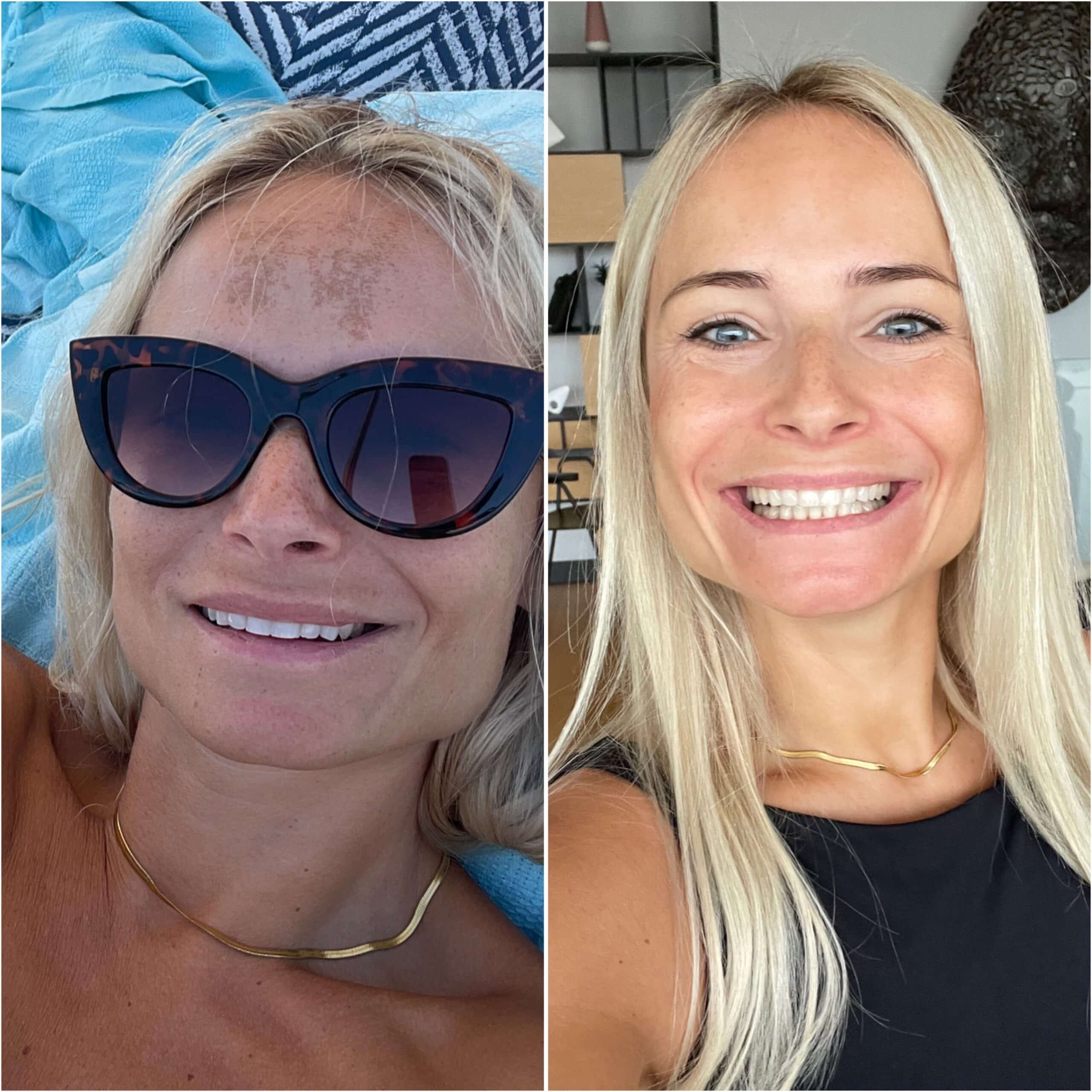 Afbeelding productoptie